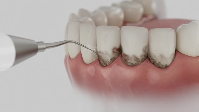 Trusted Teeth Whitening service in Grand Blanc, MI - Dentist Open Now